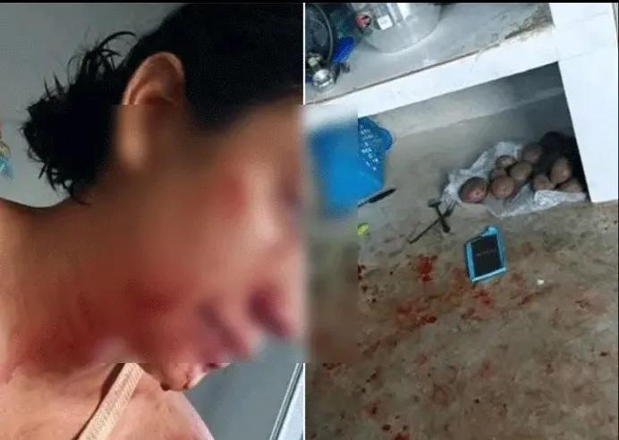 salteña golpeada 242