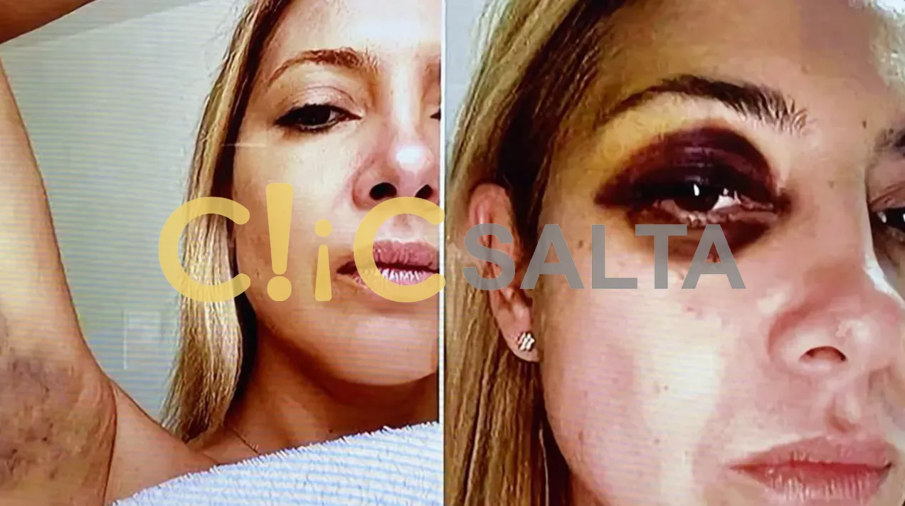 Fabiola yañez golpes